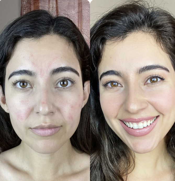 Artyclean Skin Pro, rajeunir votre visage en 15 jours avec notre massage sonique