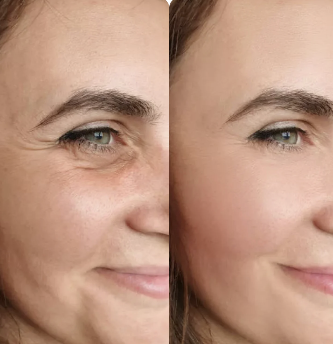 Artyclean Skin Pro, rajeunir votre visage en 15 jours avec notre massage sonique