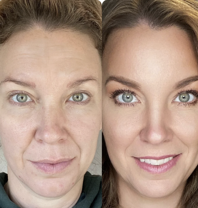 Artyclean Skin Pro, rajeunir votre visage en 15 jours avec notre massage sonique